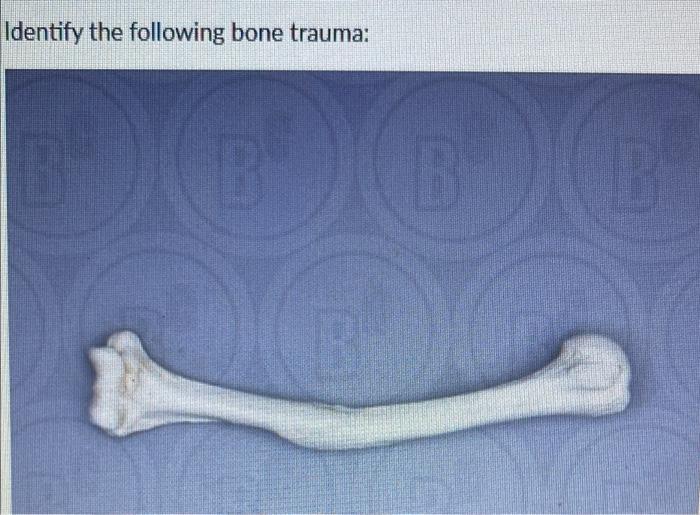 Identify The Following Bone Trauma 18 B 0 B B 1