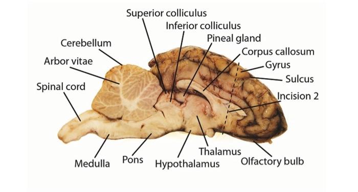 Cerebellum Arbor Vitae Spinal Cord Medulla Superior Colliculus Pons Inferior Colliculus Pineal Gland Corpus Callosum Gy 1