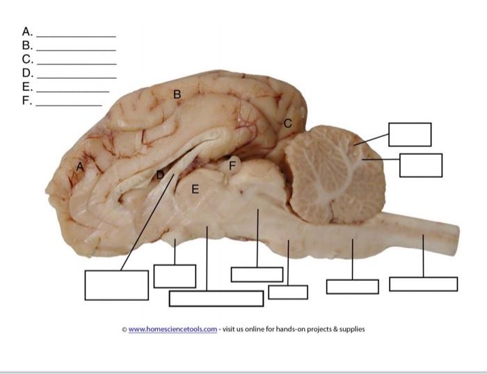 Cerebellum Arbor Vitae Spinal Cord Medulla Superior Colliculus Pons Inferior Colliculus Pineal Gland Corpus Callosum Gy 2