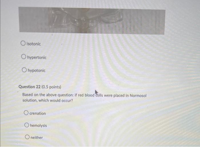 Question 1 0 5 Points Saved Benedicts Test Is Used To Test For The Presence Of Glucose Olodine Starch Silver Chlo 17