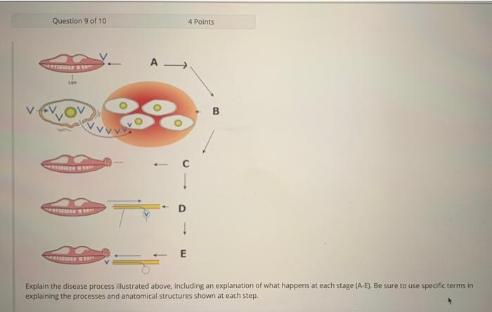 Question 9 Of 10 Filemey Wer Lije Particule Wyra T I E Explain The Disease Process Illustrated Above Including An Expla 1
