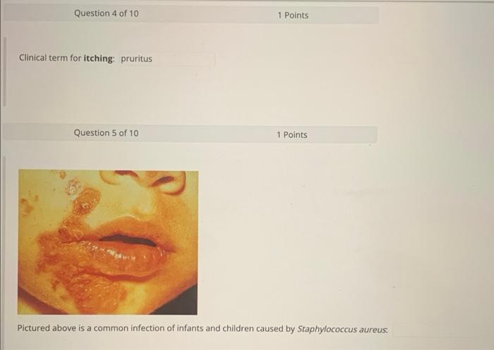 Question 9 Of 10 Filemey Wer Lije Particule Wyra T I E Explain The Disease Process Illustrated Above Including An Expla 5