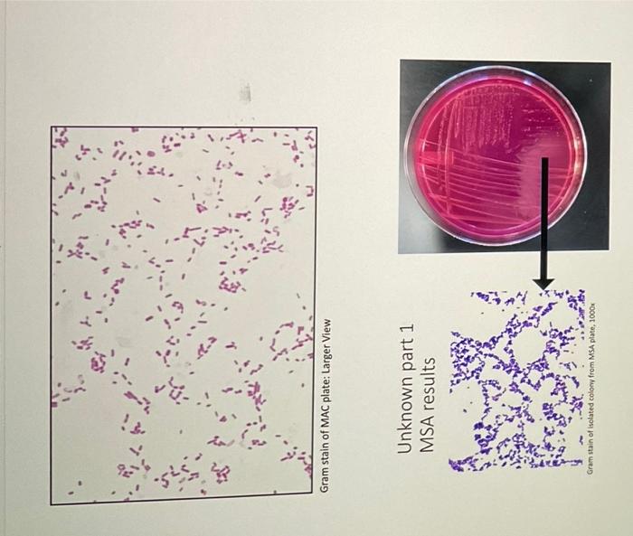 Unknown Part 1 Results Isolate 1 Isolate 2 Tsa Plate Unknown Part 1 Results Isolate 1 Gram Stain Of Isolated Colony Fro 4