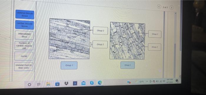 Skeletal Muscle Fissue Cardiac Muscle Tissue Intercalated Discs Nucleus Of Cardiac Muscle Cell Nucles Skeletal Muscle Fi 1