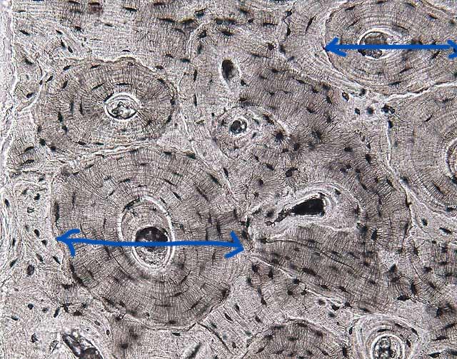 Identify The Labeled Structure And Type Of Tissue Shown 1 Adipocytes Fat 2 Tonsils Tongue 3 Islet Of Langerhans P 1