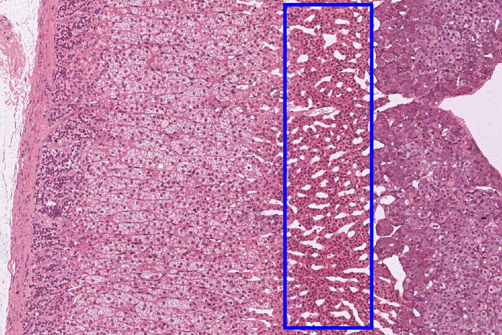 Identify The Region Indicated By The Rectangle 1 Zona Fasiculata 2 Zona Reticularis 3 Adrenal Medulla 4 Adrenal Cap 1