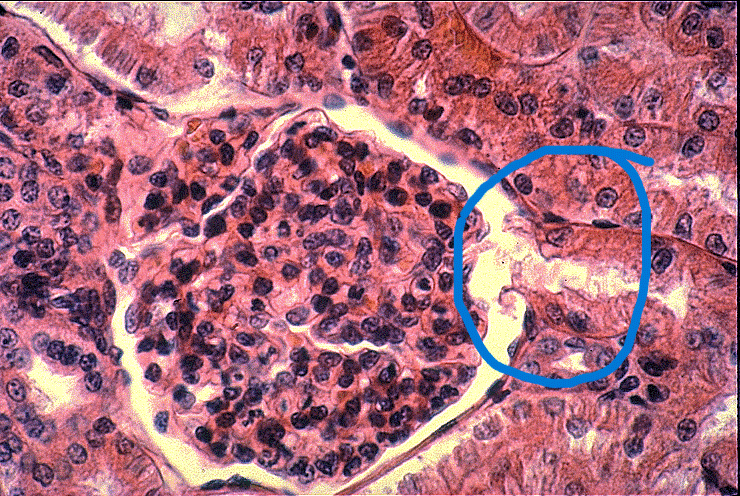 What Is Shown Contained Within The Circle A Vascular Pole Proximal Convuluted Tubule B Glomerulus C Urinary Pole Pro 1
