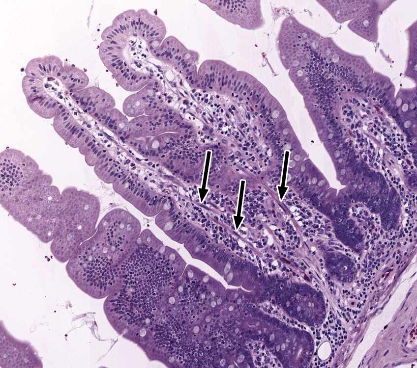 Plati 1