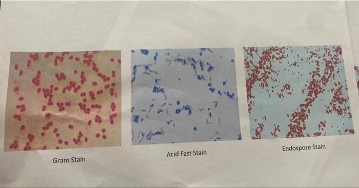 Signature Di Unknown Specimen Number 5 If Left Blank Or Wrong This Is Your Patient Id Neglecting To Label Or Mis 2