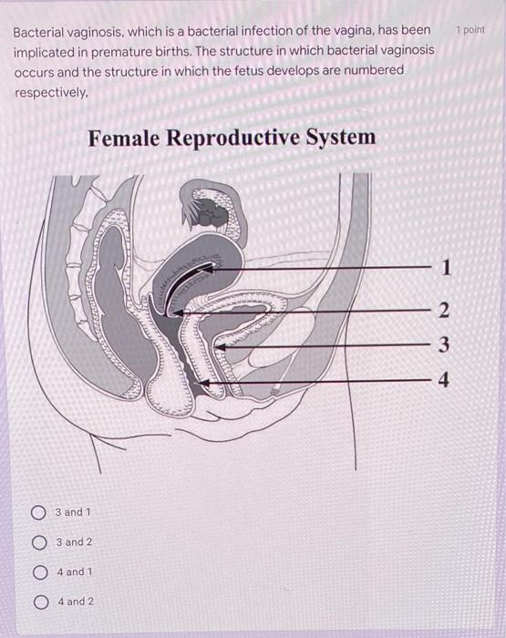 Match The Number From The Diagram And Description To The Name Of The 5 Points Component Of The Female Reproductive Syste 2