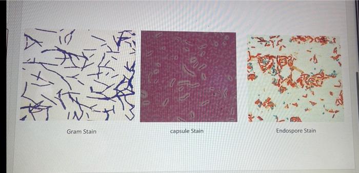 Gram Stain Capsule Stain Endospore Stain 6 Pts 6 Pts Gram Stain Reaction Bacterial Cell Shape Bacterial Cell Arrangem 1