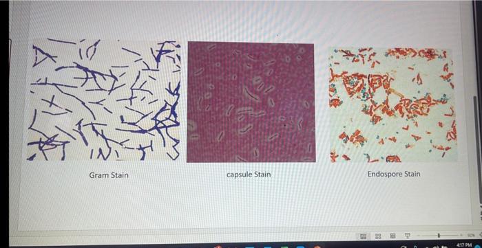 6 Pts 6 Pts Gram Stain Reaction Bacterial Cell Shape Bacterial Cell Arrangement Is This An Acid Fast Organism Yes No 2