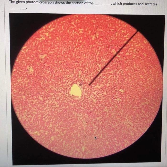 The Given Photomicrograph Shows The Section Of The Which Produces And Secretes 1