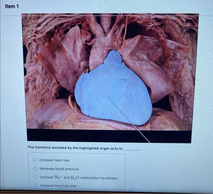 Item 1 The Hormone Secreted By The Highlighted Organ Acts To Increase Heart Rate Decrease Blood Pressure Increase Na And 1