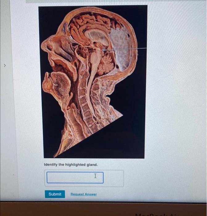 Identify The Highlighted Gland I Submit Request Answer 1