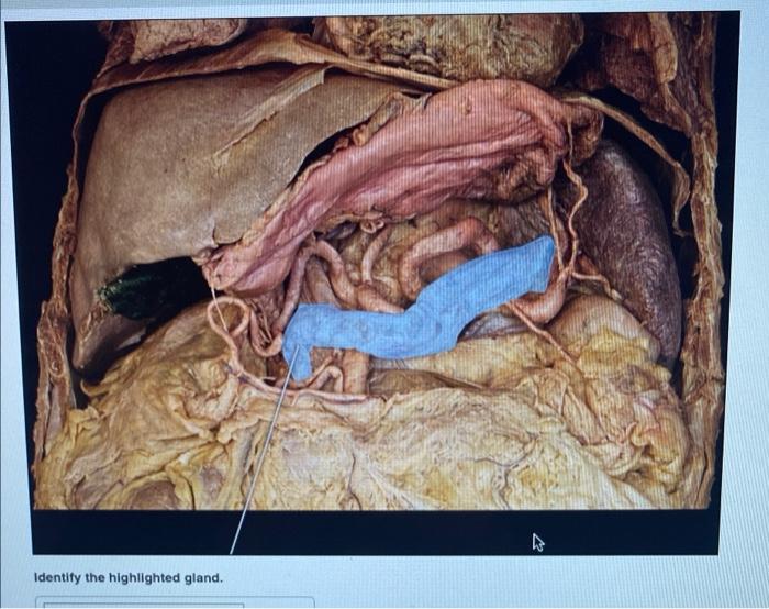 Identify The Highlighted Gland 4 1