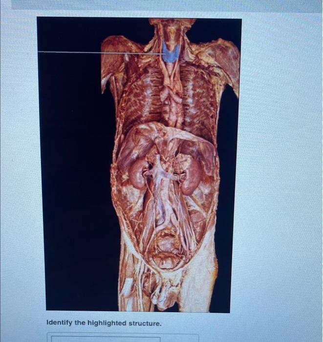 Identify The Highlighted Structure 1