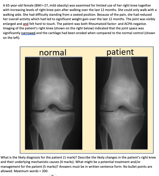 A 65 Year Old Female Bmi 27 Mild Obesity Was Examined For Limited Use Of Her Right Knee Together With Increasing Leve 1
