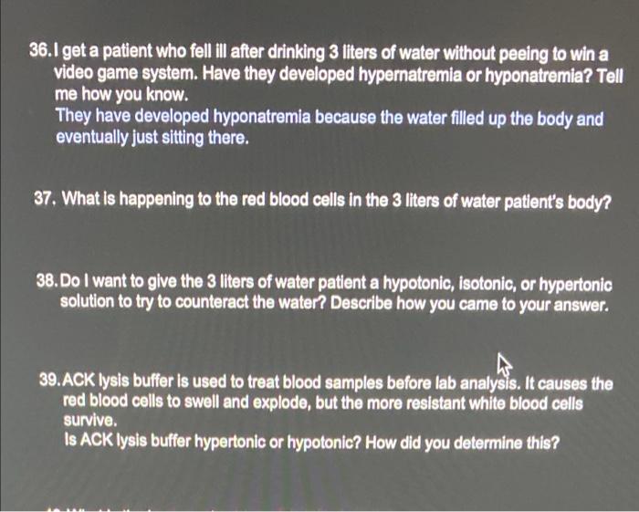 36 1 Get A Patient Who Fell Ill After Drinking 3 Liters Of Water Without Peeing To Win A Video Game System Have They De 1