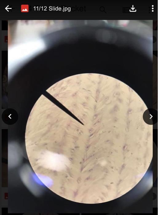 Cartilage Fibro This Type Of Cartilage Is Extremely Strong But Somewhat Flexible It Is Found In Areas Needed For Stre 2