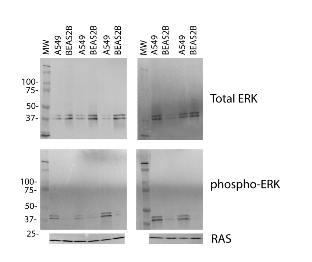 B Western Blot Method For B After Transfer Of Proteins To Nitrocellulose Laboratory Staff Will Incubate The Membrane 1