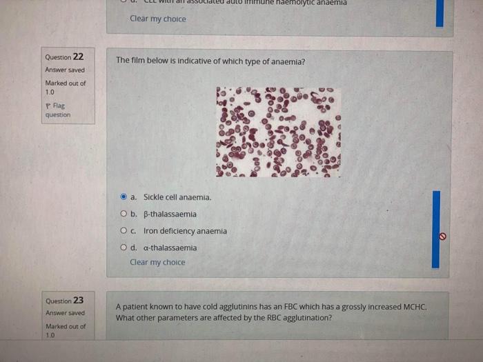 Question 22 Answer Saved Marked Out Of 1 0 P Flag Question Question 23 Answer Saved Marked Out Of 1 0 Naemolytic Anaemia 1