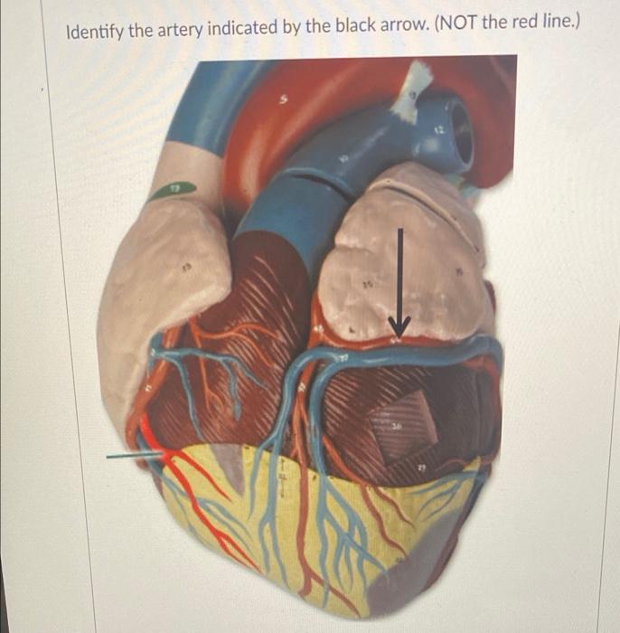 Identify The Artery Indicated By The Black Arrow Not The Red Line 1