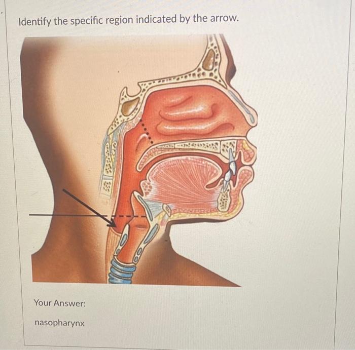 Identify The Specific Region Indicated By The Arrow Your Answer Nasopharynx 1