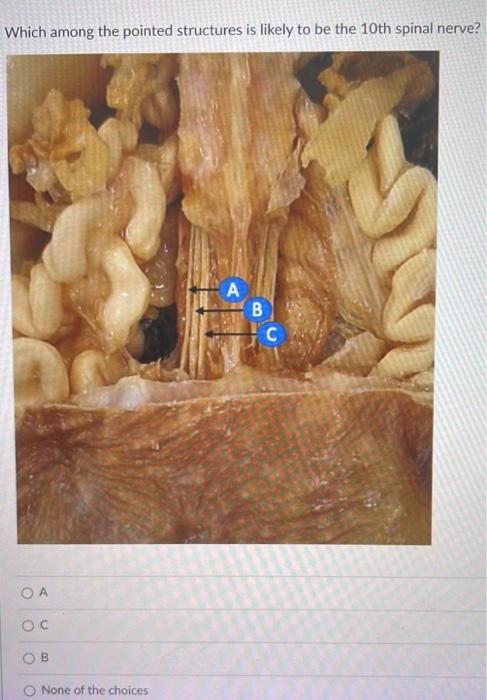 Which Among The Pointed Structures Is Likely To Be The 10th Spinal Nerve A Oa Oc B None Of The Choices B C 1