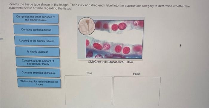 Identify The Tissue Type Shown In The Image Then Click And Drag Each Label Into The Appropriate Category To Determine W 1