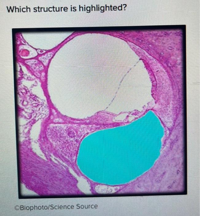 Which Structure Is Highlighted Oblophoto Science Source 1