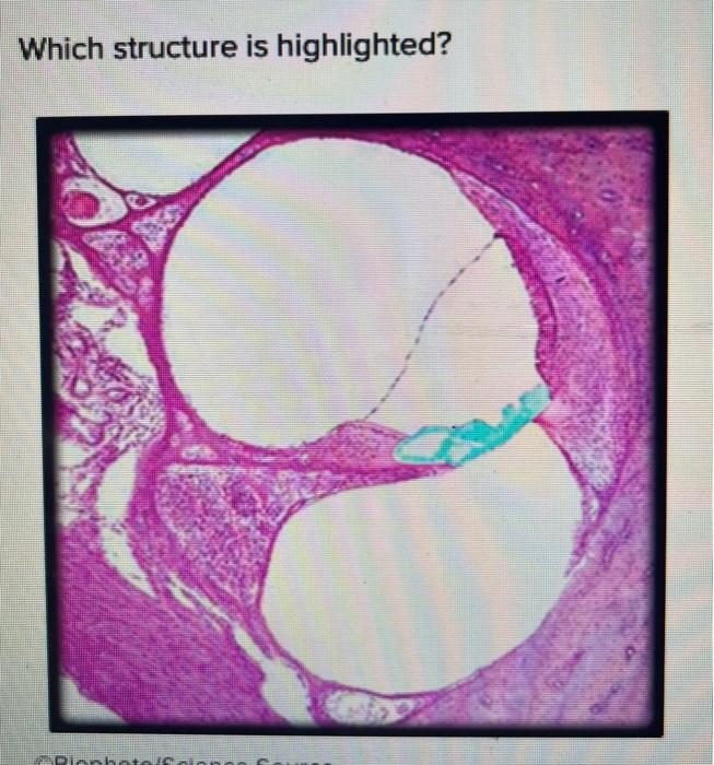 Which Structure Is Highlighted Pionhote Science 1