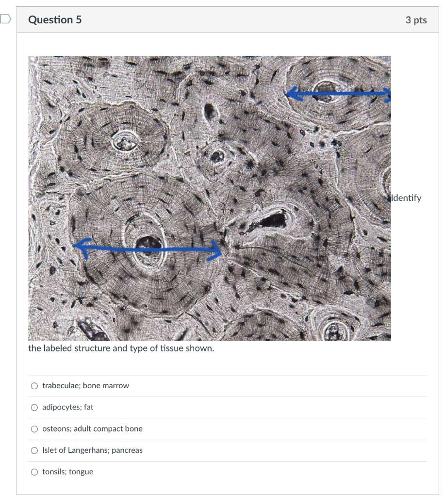Question 5 The Labeled Structure And Type Of Tissue Shown O Trabeculae Bone Marrow O Adipocytes Fat O Osteons Adult 1