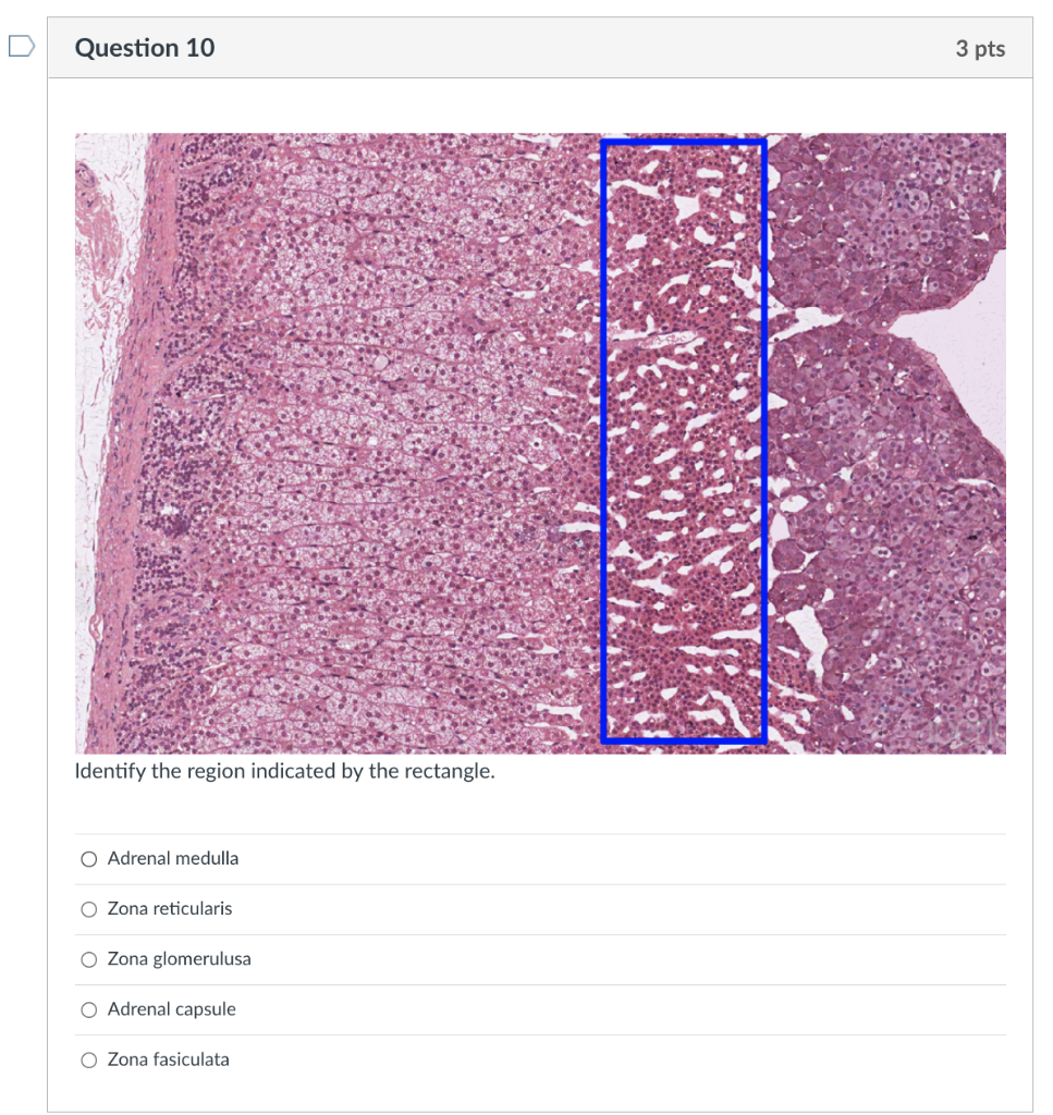 Question 10 Identify The Region Indicated By The Rectangle O Adrenal Medulla O Zona Reticularis O Zona Glomerulusa O Ad 1
