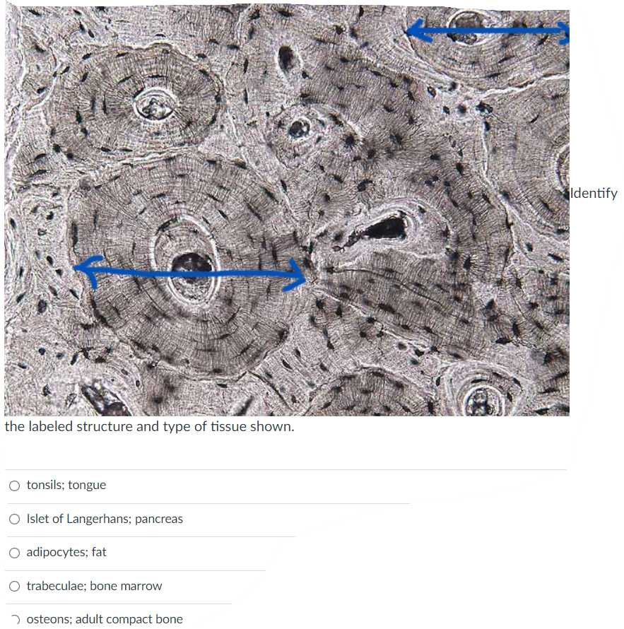 The Labeled Structure And Type Of Tissue Shown O Tonsils Tongue O Islet Of Langerhans Pancreas O Adipocytes Fat O Tr 1