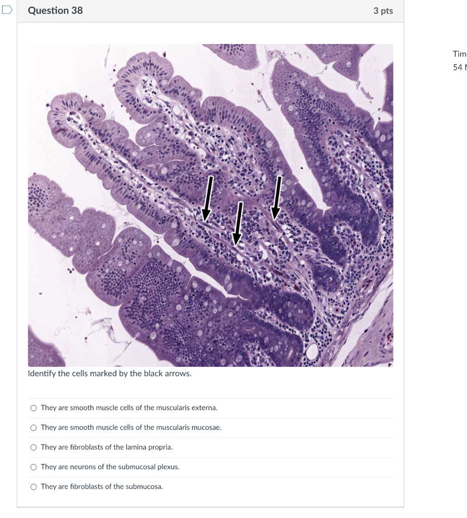 Question 38 Identify The Cells Marked By The Black Arrows O They Are Smooth Muscle Cells Of The Muscularis Externa O T 1