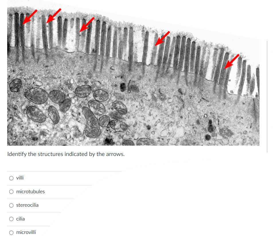 Identify The Structures Indicated By The Arrows Villi Microtubules Stereocilia Cilia Microvilli 11 In Which Places Str 1