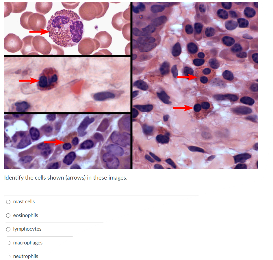 Identify The Cells Shown Arrows In These Images Mast Cells O Eosinophils Olymphocytes Macrophages Neutrophils Whic 1