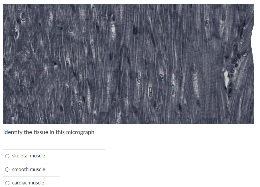 Identify The Tissue In This Micrograph Skeletal Muscle Smooth Muscle Cardiac Muscle Each Of The Following Statements C 1