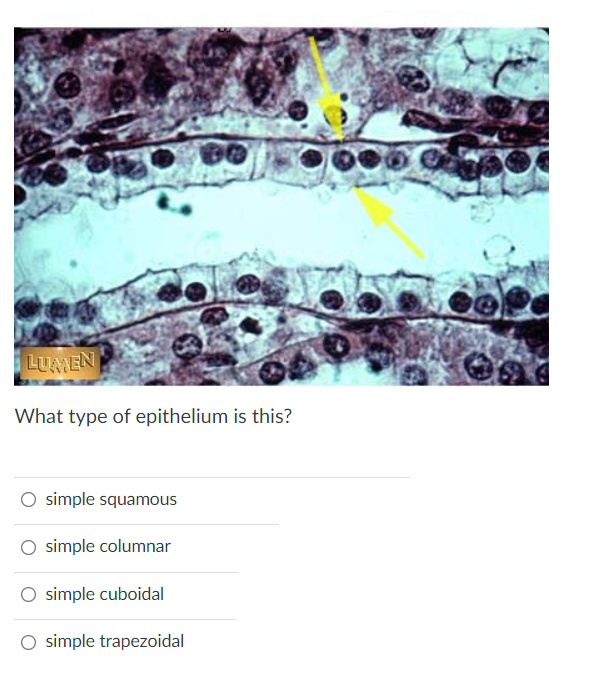 Lumen What Type Of Epithelium Is This Simple Squamous Simple Columnar Simple Cuboidal O Simple Trapezoidal Ore What Is 1