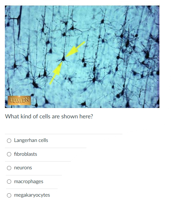 Lumen What Kind Of Cells Are Shown Here O Langerhan Cells Fibroblasts Neurons O Macrophages O Megakaryocytes Each Of T 1