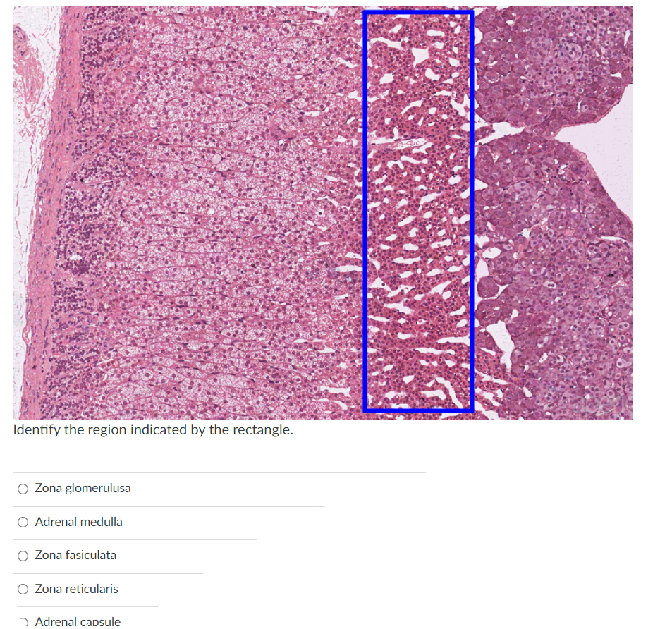 Identify The Region Indicated By The Rectangle O Zona Glomerulusa Adrenal Medulla Zona Fasiculata O Zona Reticularis Ad 1