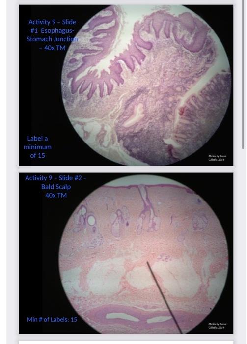 Activity 9 Slide 1 Esophagus Stomach Junction 40x Tm Label A Minimum Of 15 Activity 9 Slide 2 Bald Scalp 40x 1