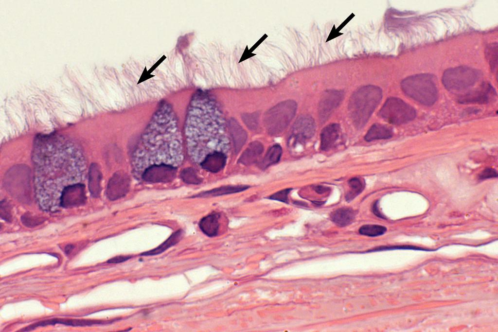 Identify The Structures Indicated By The Arrows A Microvilli B Cilia C Microtubules D Brush Borders E Stereocilia 1