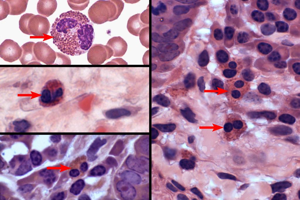 Identify The Cells Shown Arrows In These Images A Macrophages B Lymphocytes C Eosinophils D Mast Cells E Neutrop 1