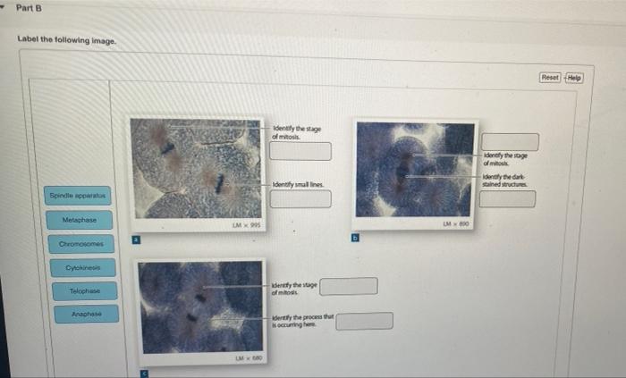 Part B Label The Following Image Spindle Apparatus Metaphase Chromosomes Cytokinesis Telophase Anaphase Lmx995 Lm 600 I 1