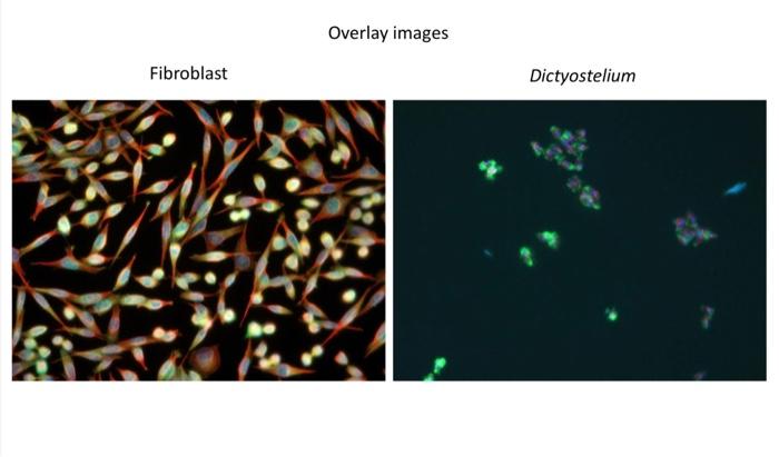 Fibroblast Overlay Images Dictyostelium Fibroblast Dictyostelium Tubulin Actin Dapi Get Calls Remove Media W Vacuum 1