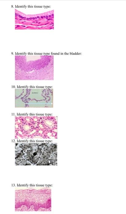 Tissue Identification Worksheet Identify The Following Tissue Types 1 Pt Each Then Answer The Questions That Follow 2