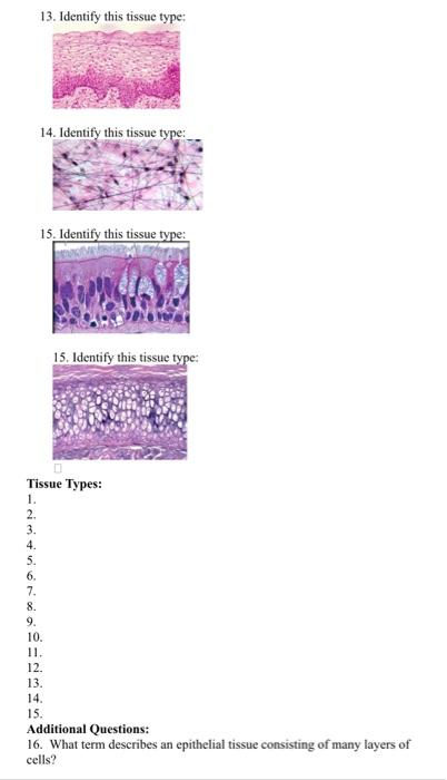 Tissue Identification Worksheet Identify The Following Tissue Types 1 Pt Each Then Answer The Questions That Follow 3