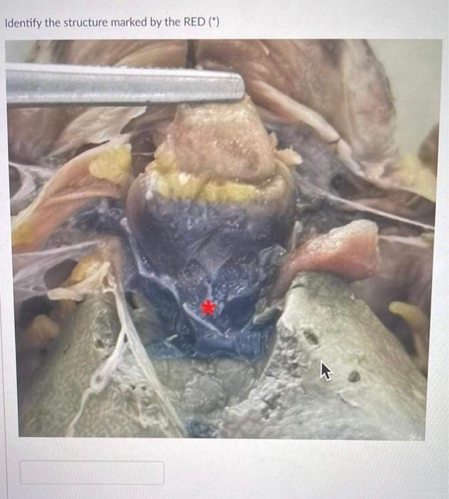 Identify The Structure Marked By The Red 1